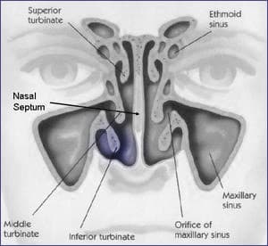 do-i-need-trubinoplasty